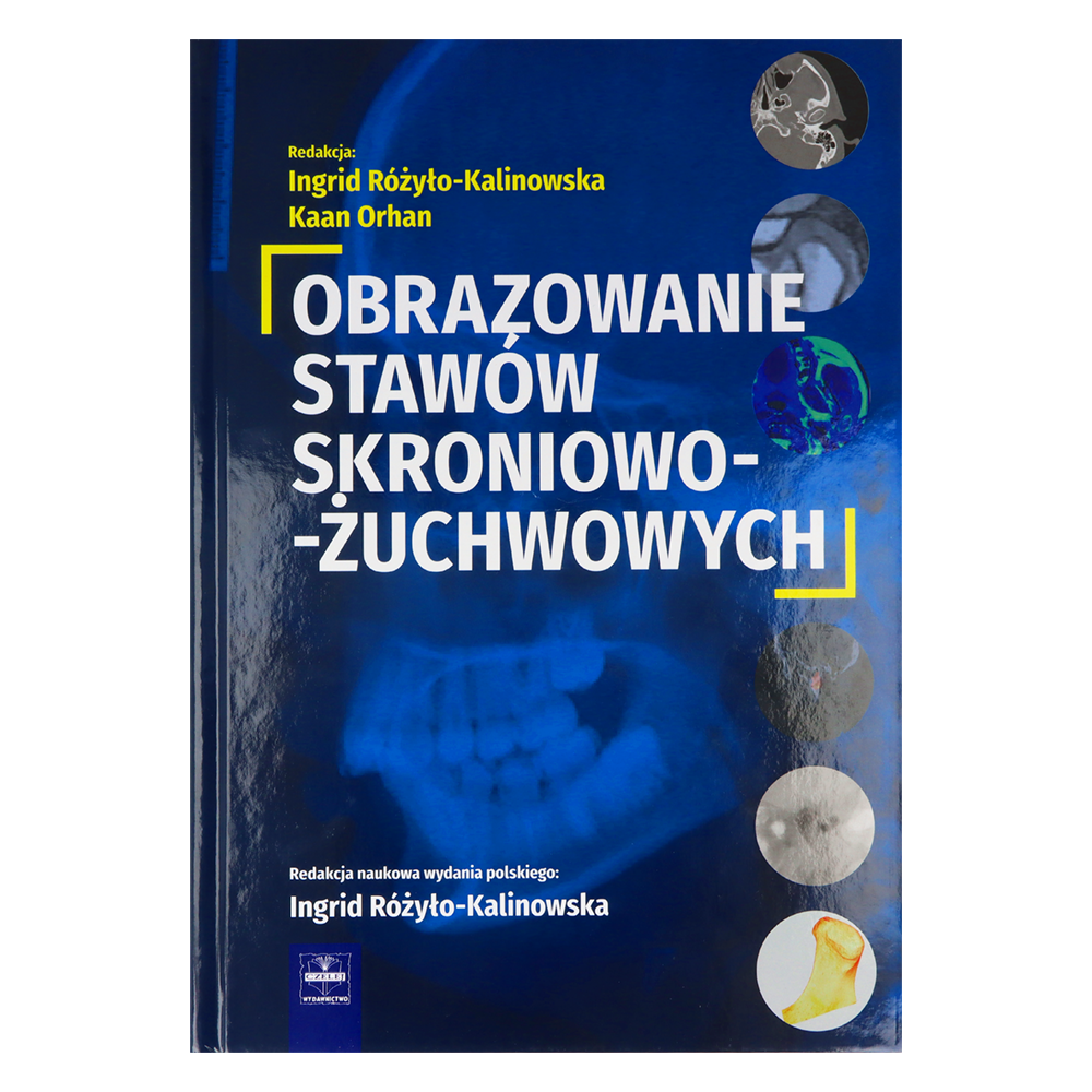 Обследование/визуализация височно-нижнечелюстных суставов (ВНЧС)