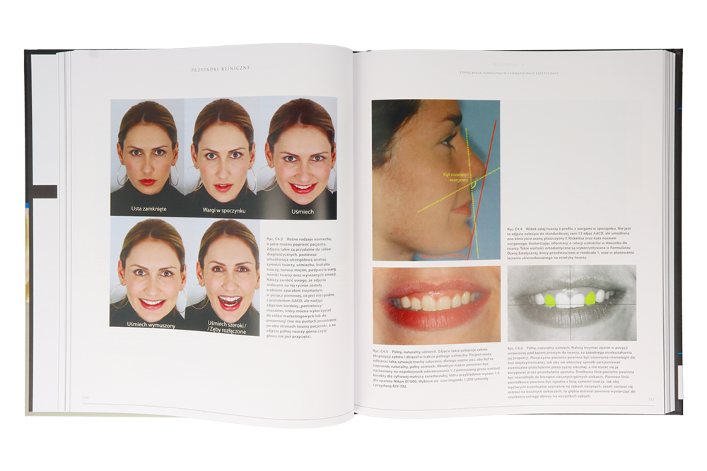 Книга: Стоматология эстетическая — Smile Design (Edra Urban & Partner)