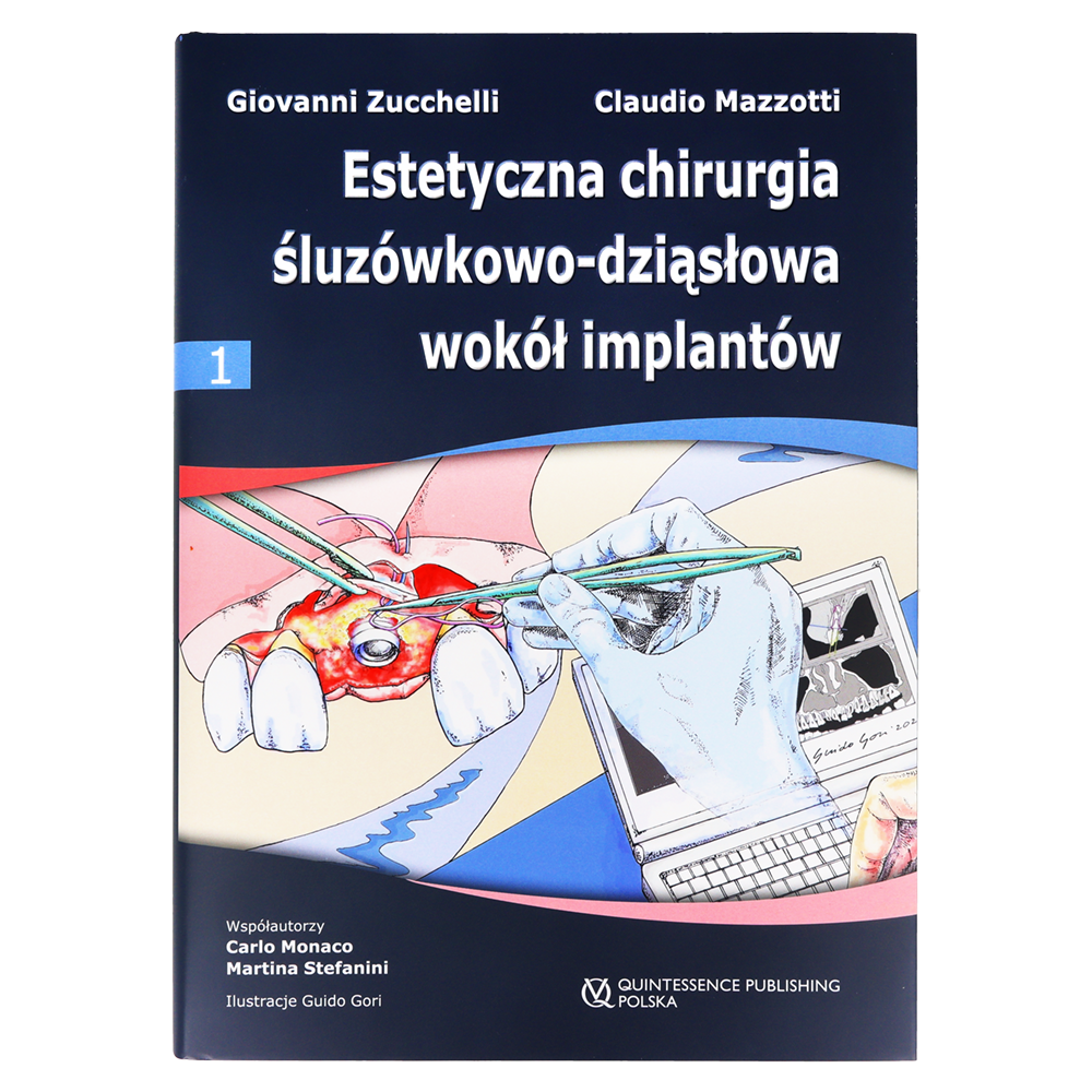 Дж. Зуккелли, К. Маццотти — Эстетическая мукогингивальная хирургия вокруг имплантатов