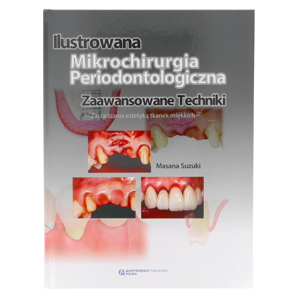 Книга: Иллюстрированная микрохирургия пародонтологии (М. Судзуки)